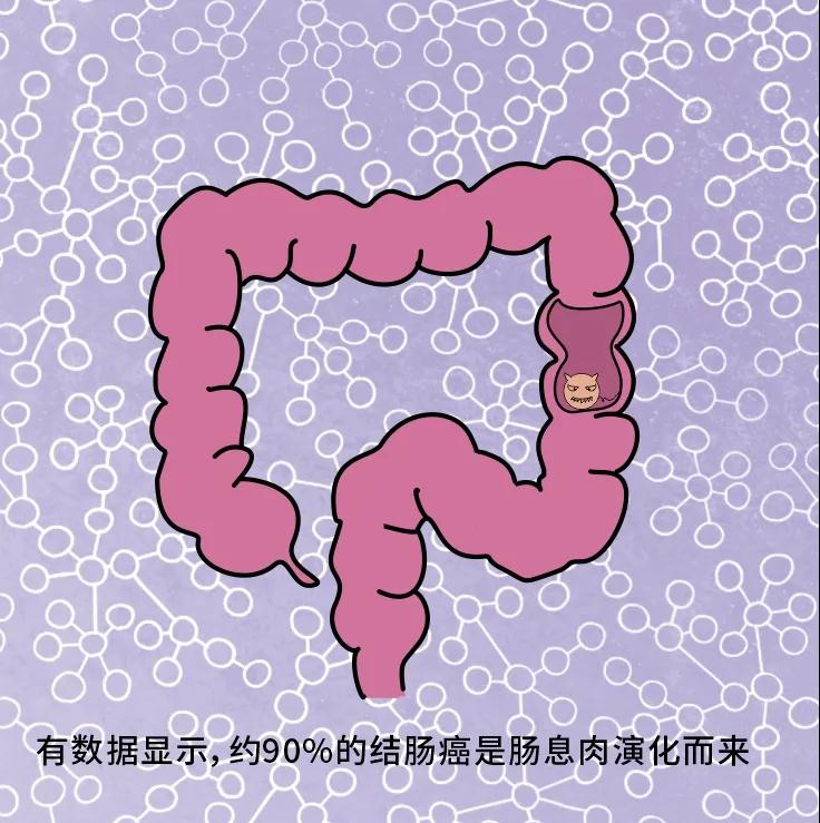 奪走“黑豹”生命的結(jié)腸癌，到底什么來(lái)頭？