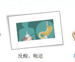 關(guān)愛(ài)身體健康，輕松檢查胃腸